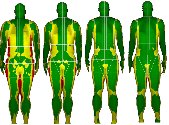 body-composition